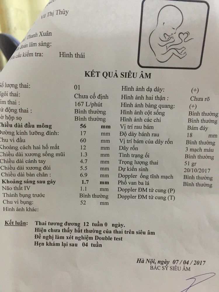 Thai 12 tuần nhịp tim 167 là trai hay gái? Bí mật giới tính bé yêu qua nhịp đập trái tim