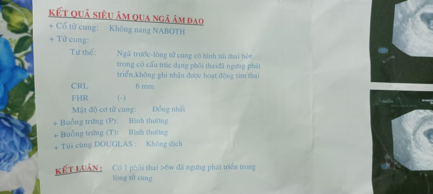 3. Mối Quan Hệ Giữa Phôi Thai Và Tim Thai